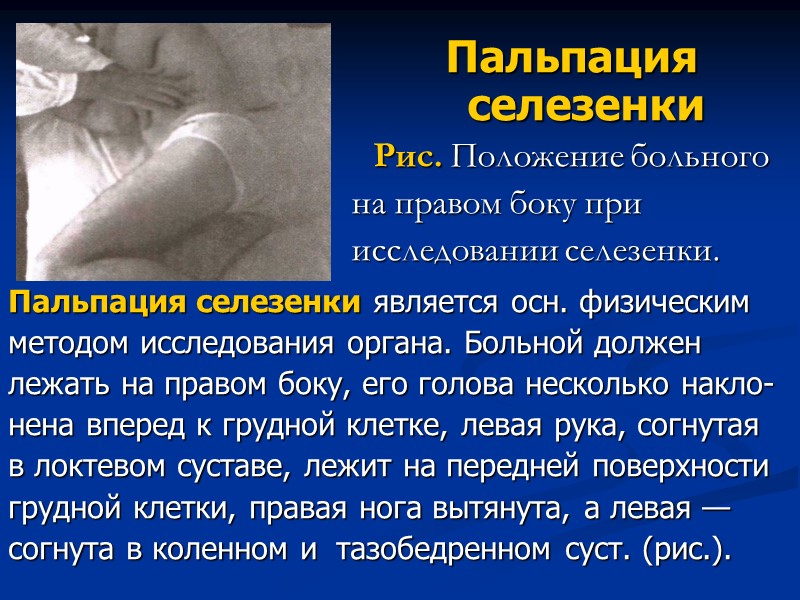 Пальпация селезенки  Рис. Положение больного на правом боку при исследовании селезенки. Пальпация селезенки